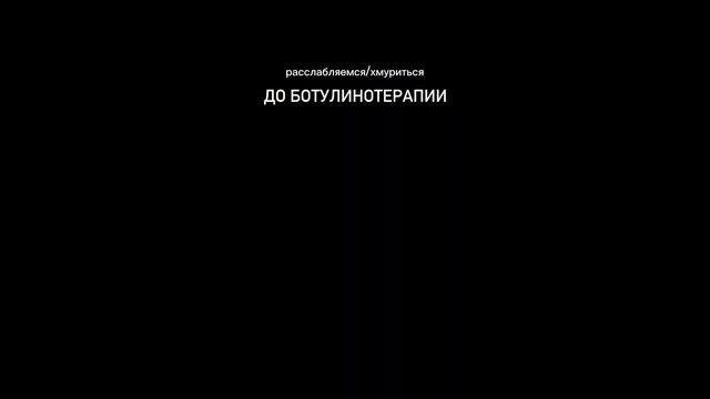 Процедура БОТУЛИНОТЕРАПИИ- это профилактика глубоких заломов ? чтобы записаться ??