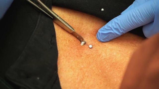 INSANE Dermal Implant PIERCING On her Chest!! смотреть онлайн