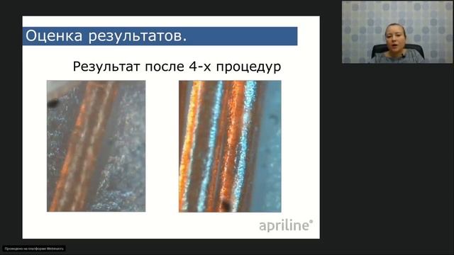 Швейцарские технологии поддержании красоты Apriline