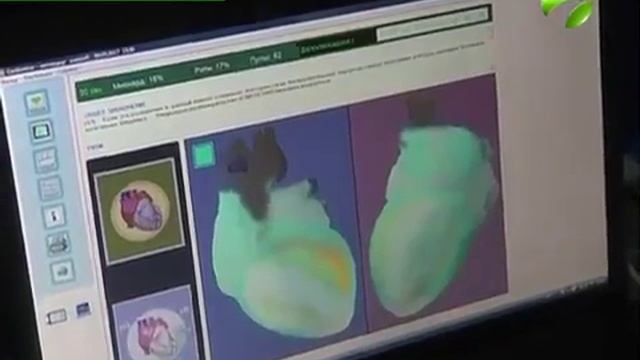 О своем здоровье должен заботиться каждый. Обследование коренных северян в Надыме смотреть онлайн