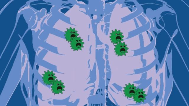 МИКРОБЫ и как с ними БОРОТЬСЯ !!! смотреть онлайн