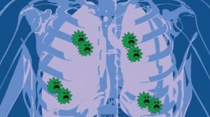 МИКРОБЫ и как с ними БОРОТЬСЯ !!!