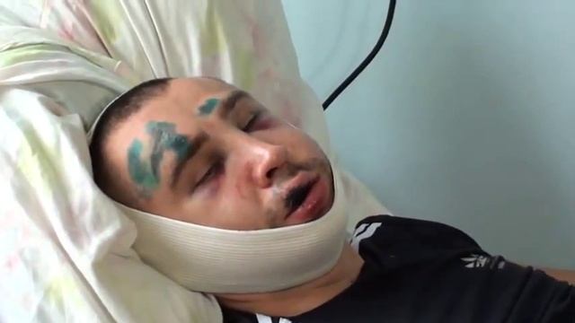 Жестокие  побои.