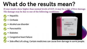 Gamma-glutamyl Transferase (GGT test ) How to Control the high level of GGT