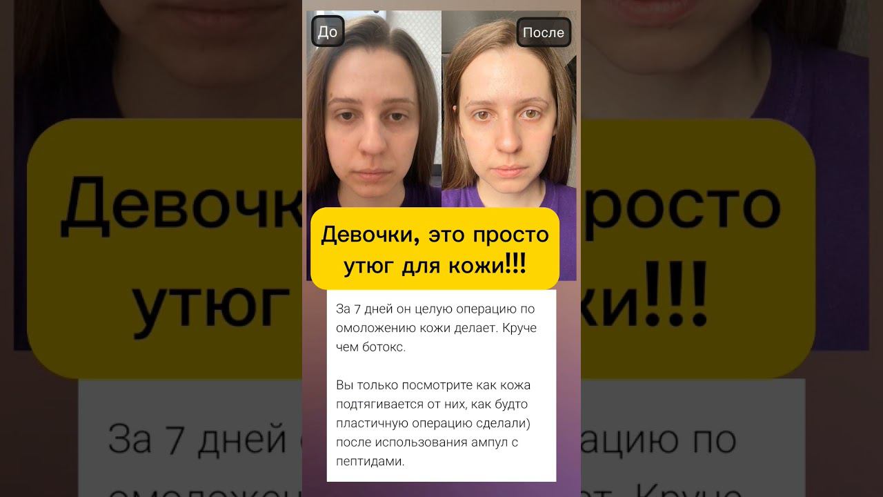 16 августа 2023 г.#идеальнаякожалица #идеальнаякожа#чистаякожа