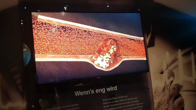 выставка Körperwelten Zürich|Строение Человека Анатомия в Цюрихе смотреть онлайн