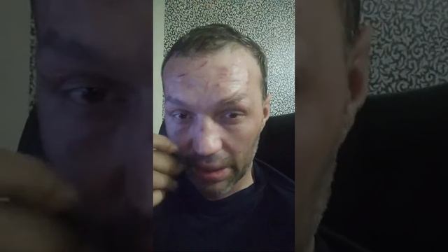 Видео Камеры В Глазах 125 Пока Живой Не Кому Помочь смотреть онлайн