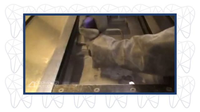 Лазерный синтез или селективное лазерное спекание при изготовлении ортопедических реставраций.