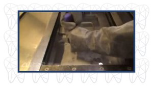 Лазерный синтез или селективное лазерное спекание при изготовлении ортопедических реставраций.