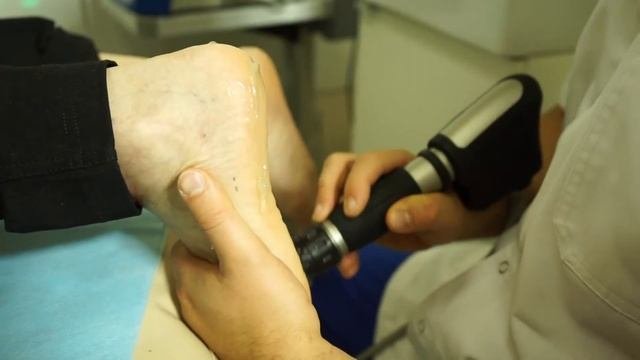 Комплексное лечение пяточной шпоры