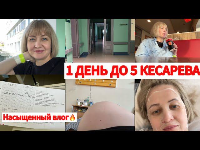 В РОДДОМЕДО 5 КЕСАРЕВА 1 ДЕНЬ