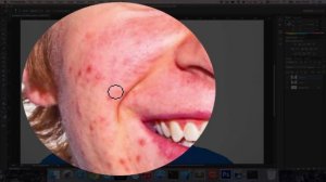 How to Remove Face Spots on Photoshop CC/CS6 [HD][4K][Tutorial] 2023