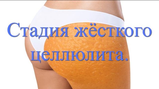 Аромамасла при фурункулёзе, цистите и целлюлите. Аромаванны, аромамассаж, аромакомпрессы.