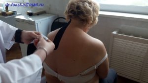 ШЕЙНЫЙ ОСТЕОХОНДРОЗ | Тейпирование | Kinesio taping
