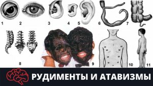 Рудименты и атавизмы. Подготовка к ЕГЭ