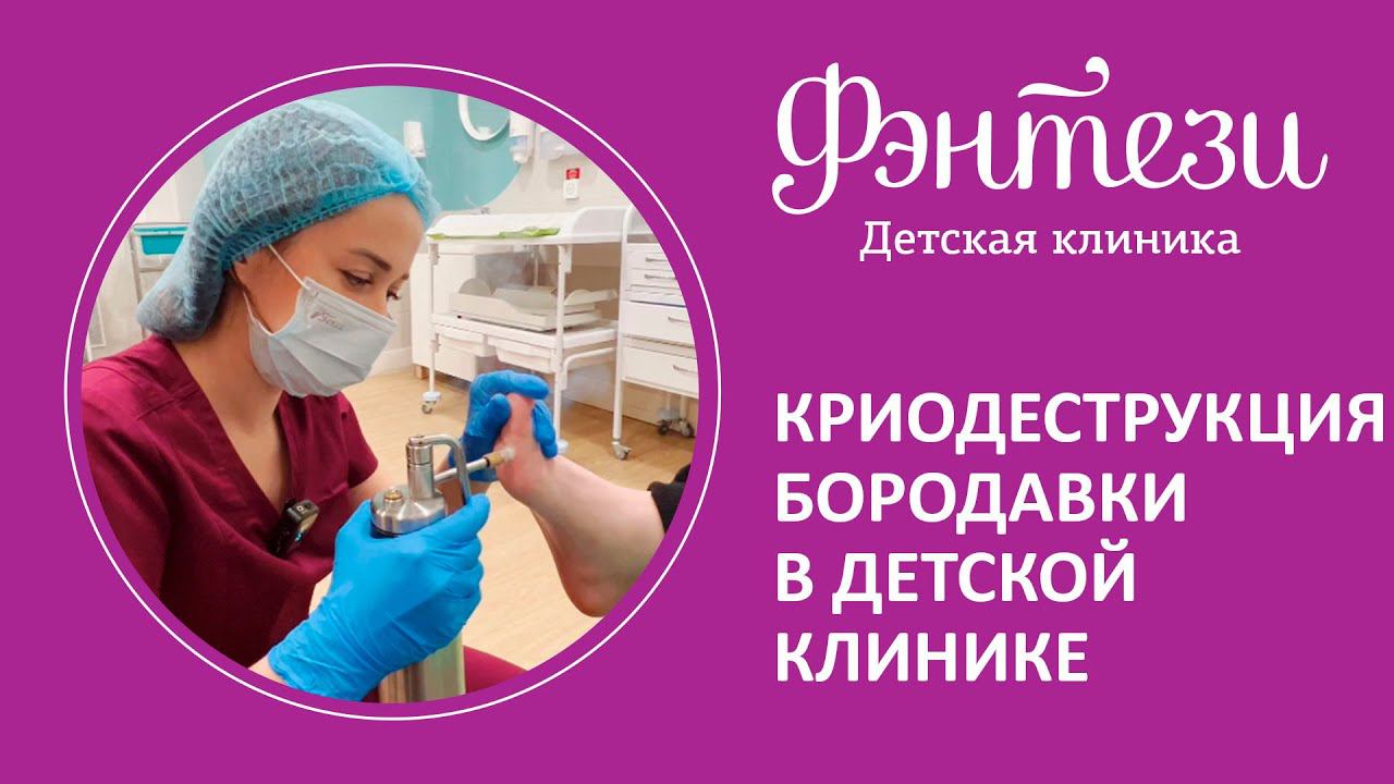 Криодеструкция бородавки в детской клинике Фэнтези
