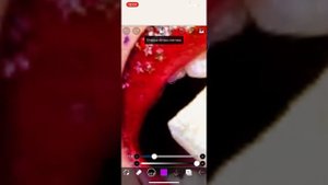 Истории Даши Рокс+ губы