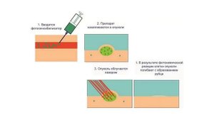 Газовые лазеры