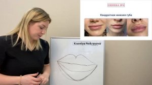 7 частых ошибок контурной пластики губ