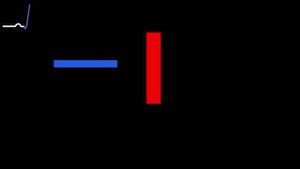 Блокада правой ножки пучка Гиса