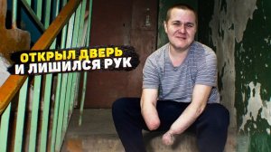 ОТКРЫЛ НЕ ТУ ДВЕРЬ, ЛИШИЛСЯ РУК И ДЕВУШКИ В 16 ЛЕТ...