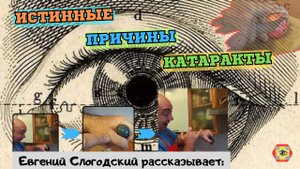 Раскрываю истинную причину возникновения катаракты! Смотрите и знайте! Развивайте зрение с нами!