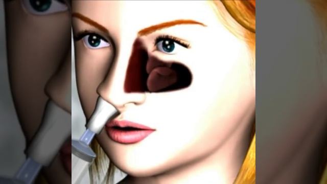 Система для промывания носа "Кукушка" смотреть онлайн