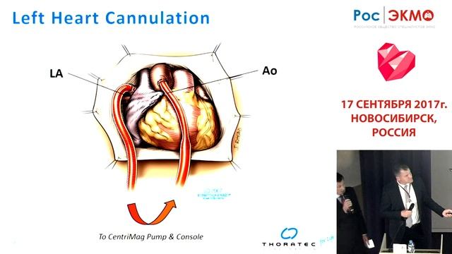 Международная школа ЭКМО, Новосибирск 17.09.2017. Йоханнес Колб смотреть онлайн
