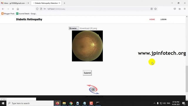 Diabetic Retinopathy Detection by means of Deep Learning | Python Final Year IEEE Project