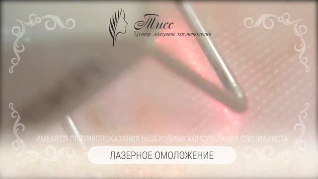 Лазерное омоложение DEKA смотреть онлайн