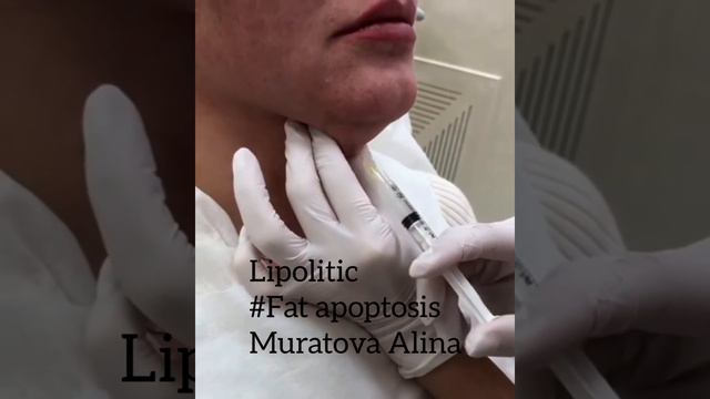 Липолитик Fat apoptosis