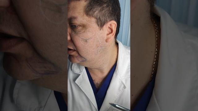 Малярный жир! Как улучшить одну из самых сложных проблем? смотреть онлайн