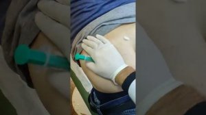 укол.уколы .правильная техника выполнения уколов внутримышечно