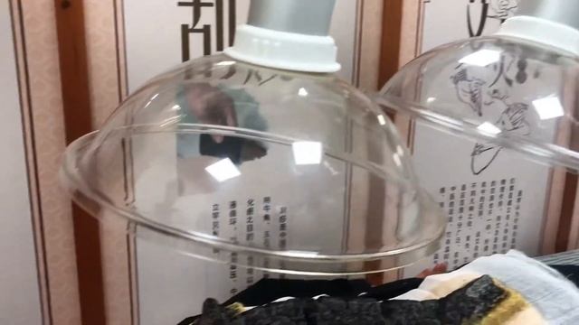 Advanced Moxibustion Techniques - Xiamen China смотреть онлайн