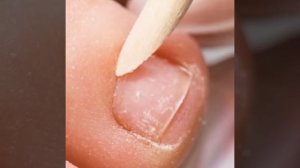 ПОТРЯСАЮЩИЕ ЛАЙФХАКИ УХОДА ЗА НОГАМИ