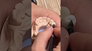 Ссылки на каналы для зубных техников и стоматологов в описании #зубнойтехник#exocad #cadcam