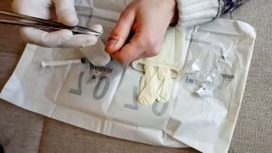 минус ноготь) подногтевая гематома.