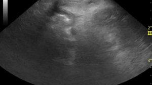 Мукоцеле, дилатация холедоха у собаки на УЗИ