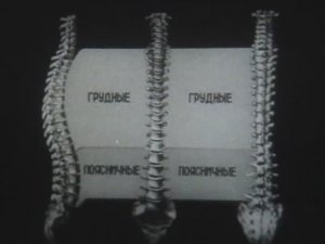 Физиология человека. Воспитание осанки и профилактика сколиоза у детей