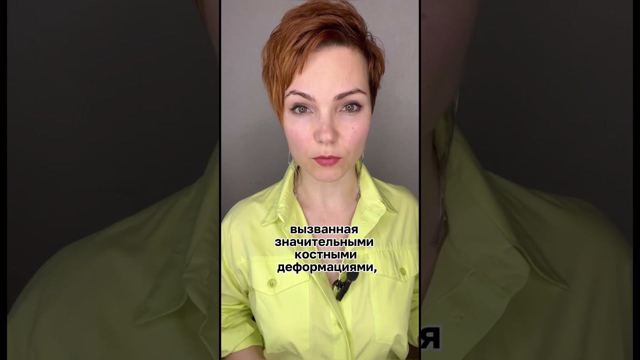 Ботокс приводит к асимметрии #фейсфитнес #асимметрия #ботокс #омоложениелица #гимнастикадлялица