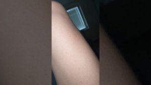 Фасцикуляции на бедре, самопроизвольные сокращения мышц