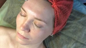 Мезороллер + CURACEN Essence – Эликсир вечной молодости, источник энергии