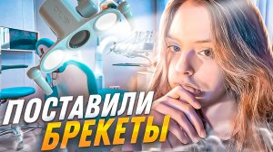 ПОСТАВИЛА БРЕКЕТЫ? СКОЛЬКО СТОИТ? | установка и стоимость брекет-системы