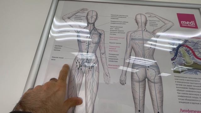 Нетипичная форма варикоза. Как лечить варикоз? Лечение вен. Флеболог Москва. Флеболог. Хирург