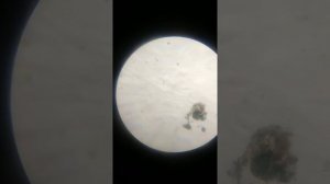 Ультрафиолет на микроорганизмы