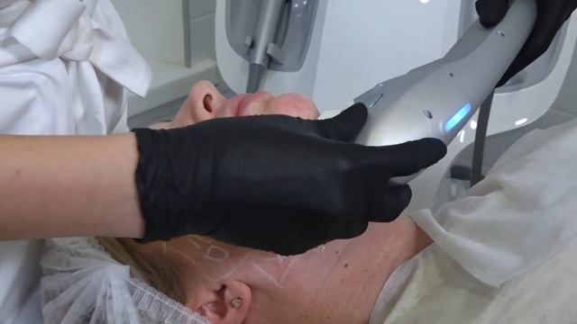 Ультраформер. Комплексный Протокол компактизации объёма лица .