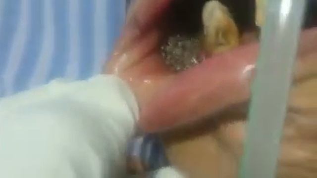 У женщины обнаружили во рту червей? смотреть онлайн