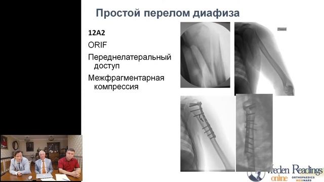 Вебинар 22 июля 17-00 (MSK) Лечение переломов диафиза плечевой кости - современные подходы.mp4