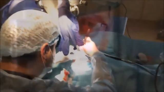 Cochlear Implantation   Кохлеарная имплантация Digisonic SP   Neurelec