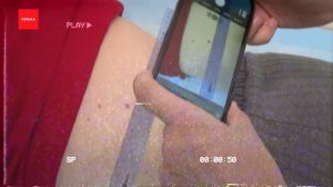 Проверить родинки можно будет онлайн